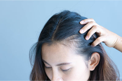 Habits that cause hair loss