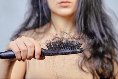 Could high testosterone be the cause of your thinning hair?