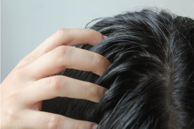 How to Deal With an Oily Scalp